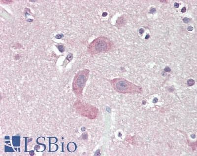 IHC-plus™ DCLK / DCLK1 Antibody