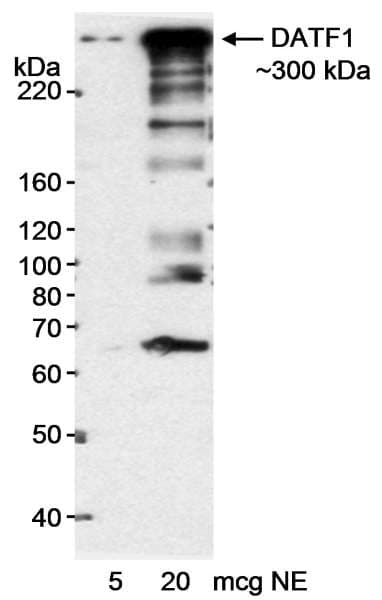 Polyclonal Rabbit anti-Human DATF1 / DIDO1 Antibody (aa300-350, WB)