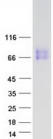 Human CSF2RA / CD116 Protein (Recombinant Myc-DDK (Flag))