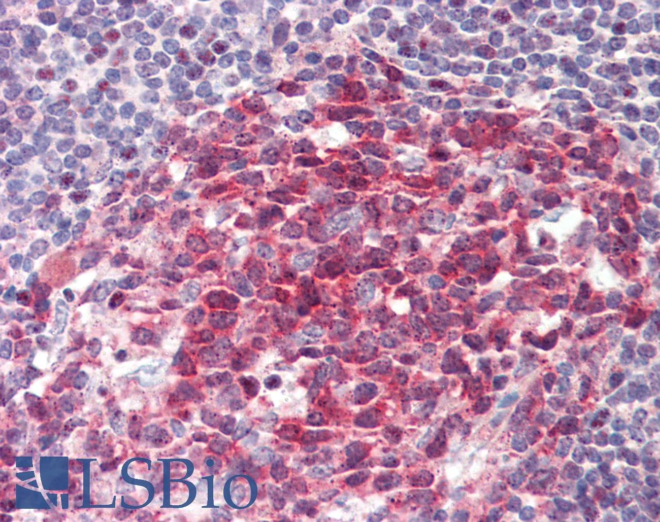 IHC-plus™ Polyclonal Rabbit anti-Human GTF2A1 / TFIIA Antibody (aa281-330, IHC, WB)