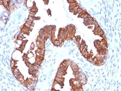 KRT7 / CK7 / Cytokeratin 7 Antibody (clone rOV-TL12/30, Azide-free, Carrier-free)