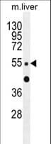 ZNF672 Antibody (aa340-368)