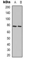 Polyclonal Rabbit anti-Human Ezrin + Radixin + Moesin Antibody (C-Terminus, IHC, WB)