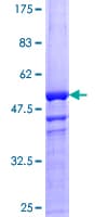 Human VEGFB Protein (Recombinant GST)
