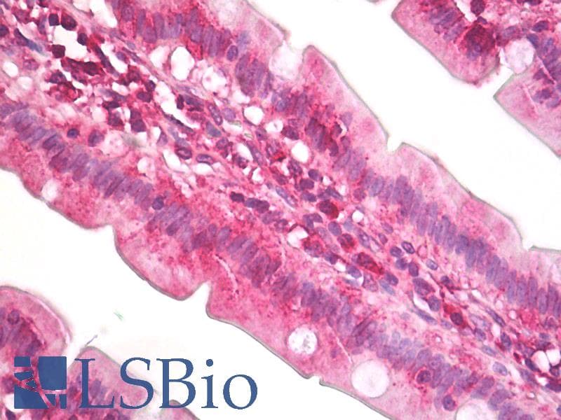 IHC-plus™ EIF4A2 Antibody (aa50-100)