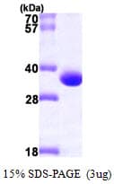 Human MAWDBP / PBLD Protein (Recombinant His)