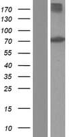 Human ACOX1 / ACOX Protein (Over-Expression Lysate Myc-DDK (Flag))