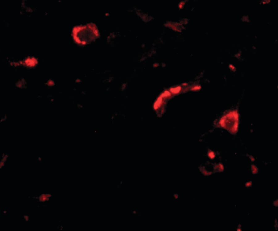 SLITRK3 Antibody