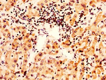 Polyclonal Rabbit anti-Human HIST1H2AI Antibody (IHC)