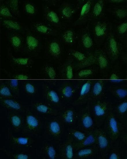 Polyclonal Rabbit anti-Human DUT / DUTPase Antibody (IHC, IF, WB)