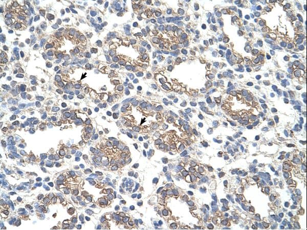 ARG1 / Arginase 1 Antibody (aa101-150)