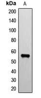Polyclonal Rabbit anti-Human ER81 / ETV1 Antibody (N-Terminus, IHC, WB)