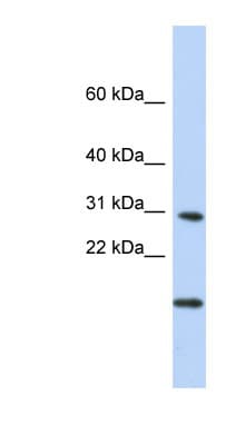 POLR2K Antibody (N-Terminus)