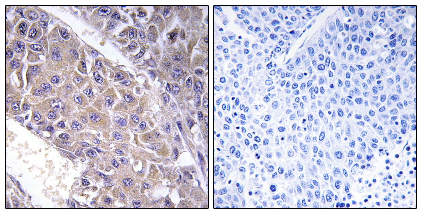 B4GALT3 Antibody (aa271-320)