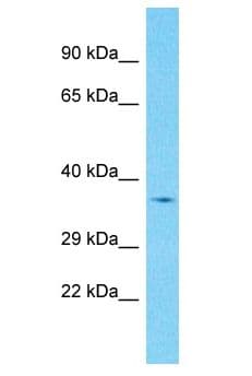OR51A7 Antibody (aa157-206)