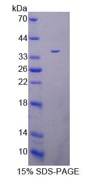 Human PADI4 / PAD4 Protein (Recombinant His-T7)