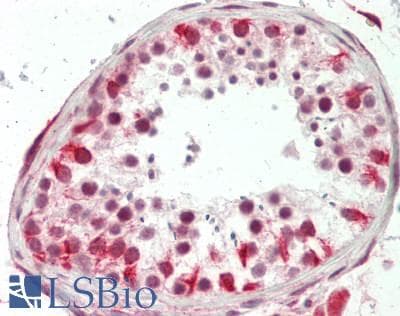 IHC-plus™ Polyclonal Rabbit anti-Human EZH1 / ENX-2 Antibody (140-220 aa, Internal, IHC, IF, WB)