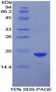 Human FDFT1 / Squalene Synthase Protein (Recombinant His)