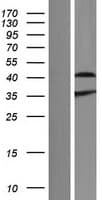 Human Aprataxin / APTX Protein (Over-Expression Lysate Myc-DDK (Flag))