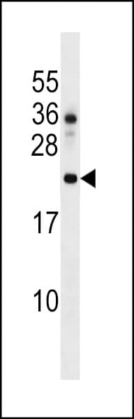 DNAJC24 Antibody (aa53-81)