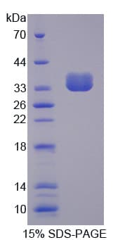 Human PTPN6 / SHP1 Protein (Recombinant His)