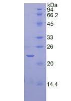 Rat SIRT3 / Sirtuin 3 Protein (Recombinant His, N-Terminal)