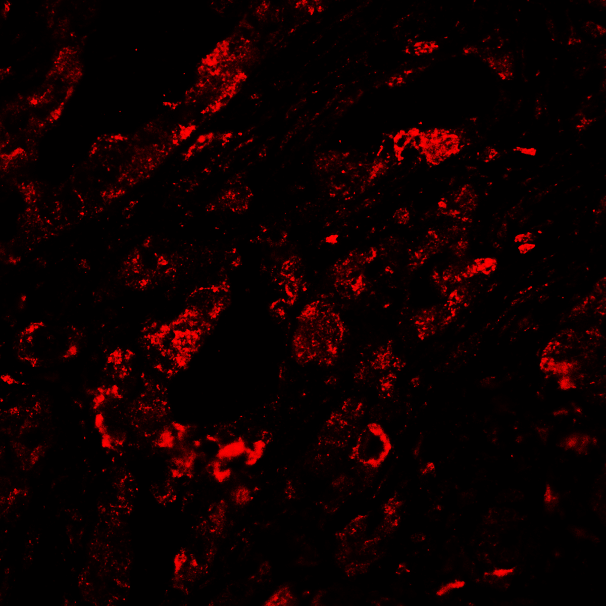 CTLA4 / CD152 Antibody (clone 8A1)