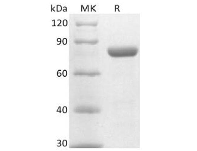 Mouse PVRL4 / Nectin 4 Protein (Recombinant Fc, C-terminus)