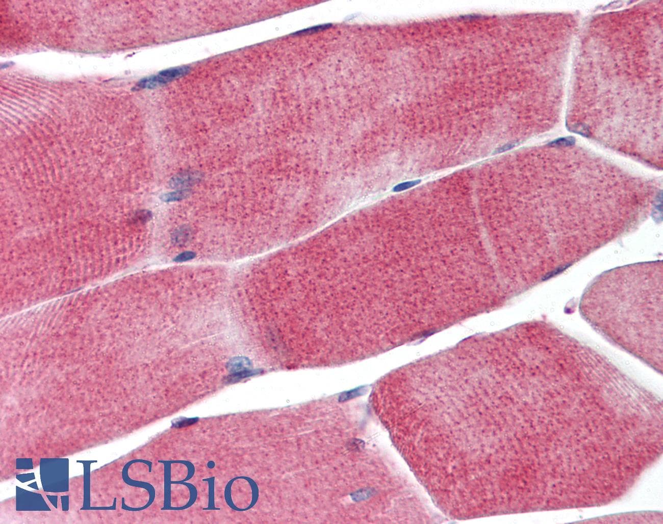 IHC-plus™ Polyclonal Rabbit anti-Human PPARG / PPAR Gamma Antibody (aa82-101, IHC, WB)
