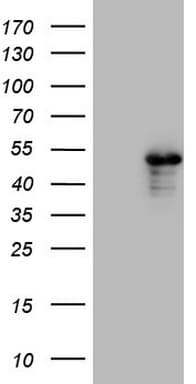 TNNT2 / CTNT Antibody (clone OTI3H2)
