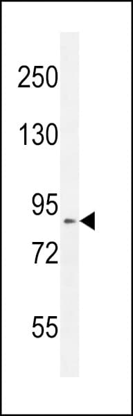 DDX11 / CHLR1 Antibody (aa656-683)