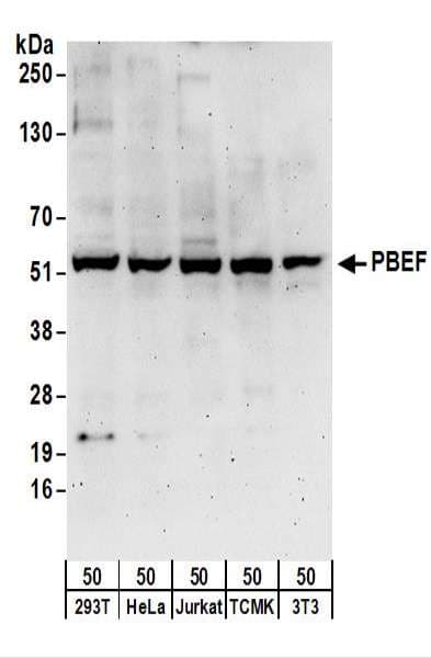 NAMPT / Visfatin Antibody (aa400-450)