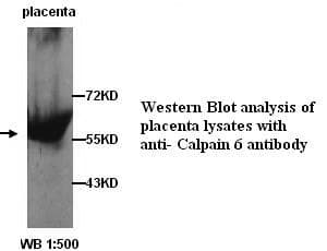 CAPN6 / Calpain 6 Antibody (C-Terminus)
