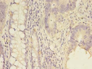 Polyclonal Rabbit anti-Human SCNN1G / ENaC Gamma Antibody (IHC)