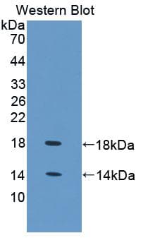 FABP4 / AP2 Antibody (aa1-125, Biotin)