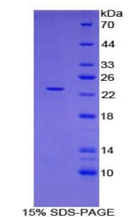 Rat FBN1 / Fibrillin 1 Protein (Recombinant 6His, N-terminus)