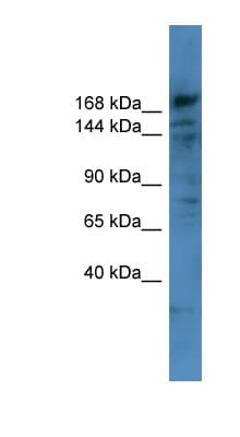 COL4A6 / Collagen IV Antibody (aa822-871)