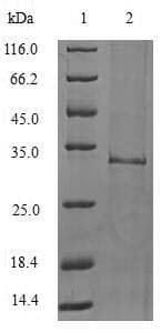 Mouse IL1F10 Protein (Recombinant 6His-SUMO, N-terminus)