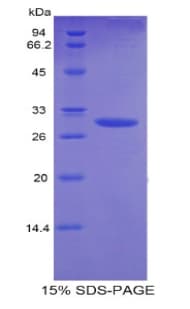 Mouse PLS3 / T Plastin Protein (Recombinant His)