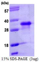Human NANOG Protein (Recombinant His)