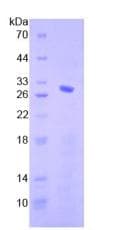 Human SMAD4 Protein (Recombinant His-T7)
