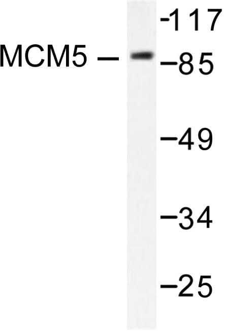 Polyclonal Rabbit anti-Human MCM5 Antibody (Phe51, IHC, IF, WB)