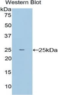 CD110 / MPL Antibody (aa66-260)