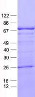 Human LZTS1 Protein (Recombinant His, N-Terminal)