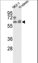 Polyclonal Rabbit anti-Human PANK1 / PANK Antibody (aa75-105, WB)