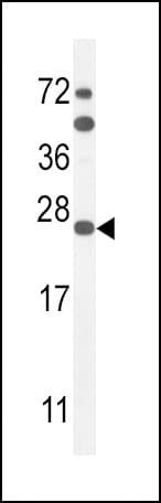 SCN1B Antibody (aa63-90)