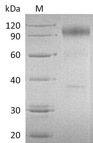 Human IL23R Protein (Recombinant Fc, C-terminus)