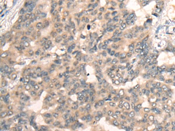 BBOX1 / BBOX Antibody