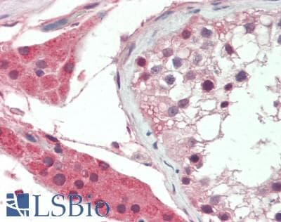 IHC-plus™ Polyclonal Rabbit anti-Human PLAT / TPA Antibody (IHC, WB)