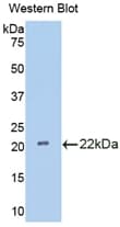 IL18BP Antibody (aa29-193, PE)